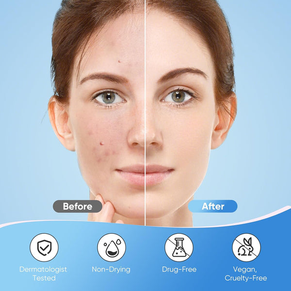 Sparkling Star Acne Patches
